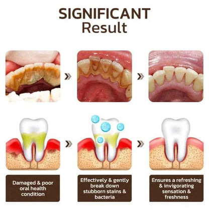 Niacinamide Whitening Toothpaste